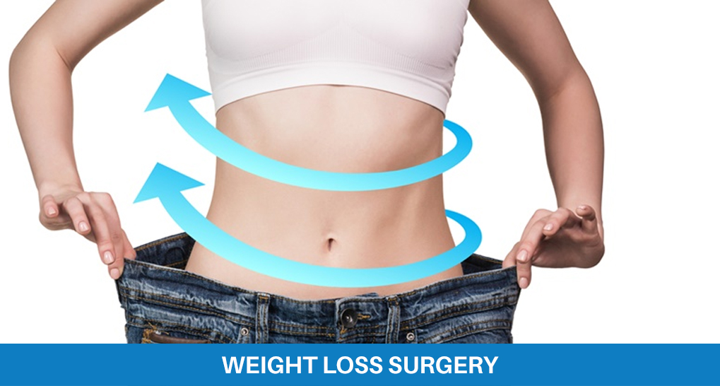 weight loss surgery treatment