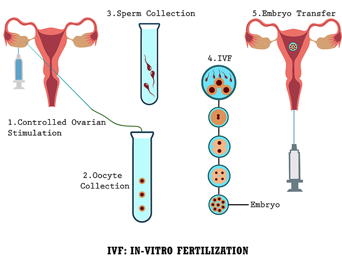 ivf centre in phagwara