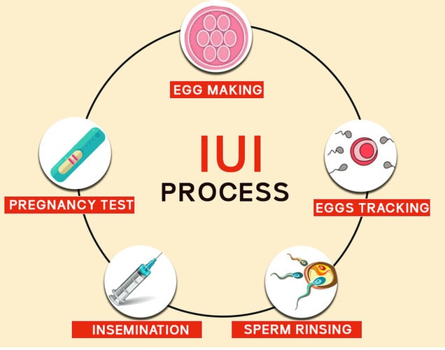 iui treatment in jalandhar