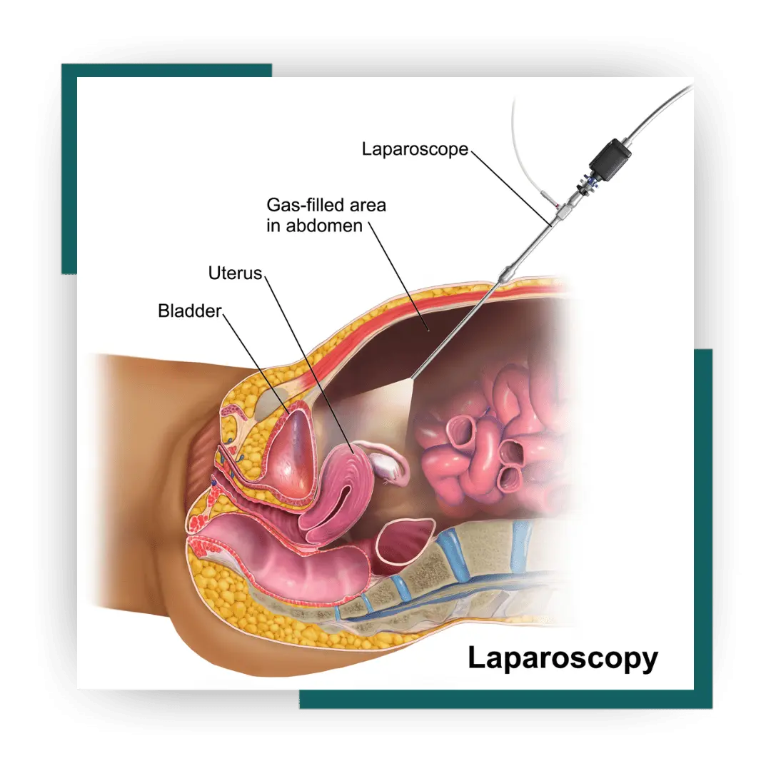 Mini Laparoscopic Surgery in Jalandhar